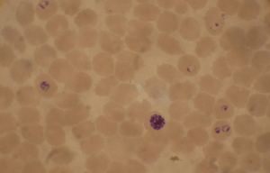 Malaria under the microscope.